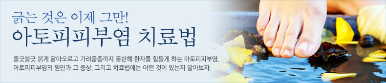 울긋불긋 붉게 달아오르고 가려움증까지 동반해 환자를 힘들게 하는 아토피피부염. 아토피피부염의 원인과 그 증상, 그리고 치료법에는 어떤 것이 있는지 알아보자.