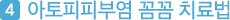 네번째,아토피피부염 꼼꼼 치료법