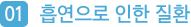 흡연으로 인한 질환