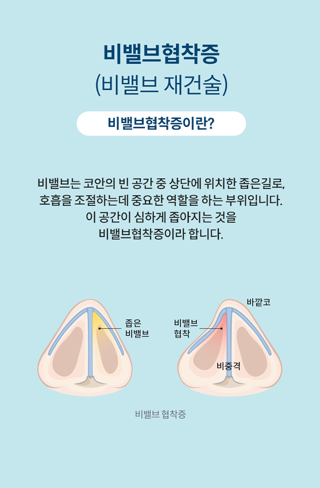 비밸브협착증 (비밸브 재건술)