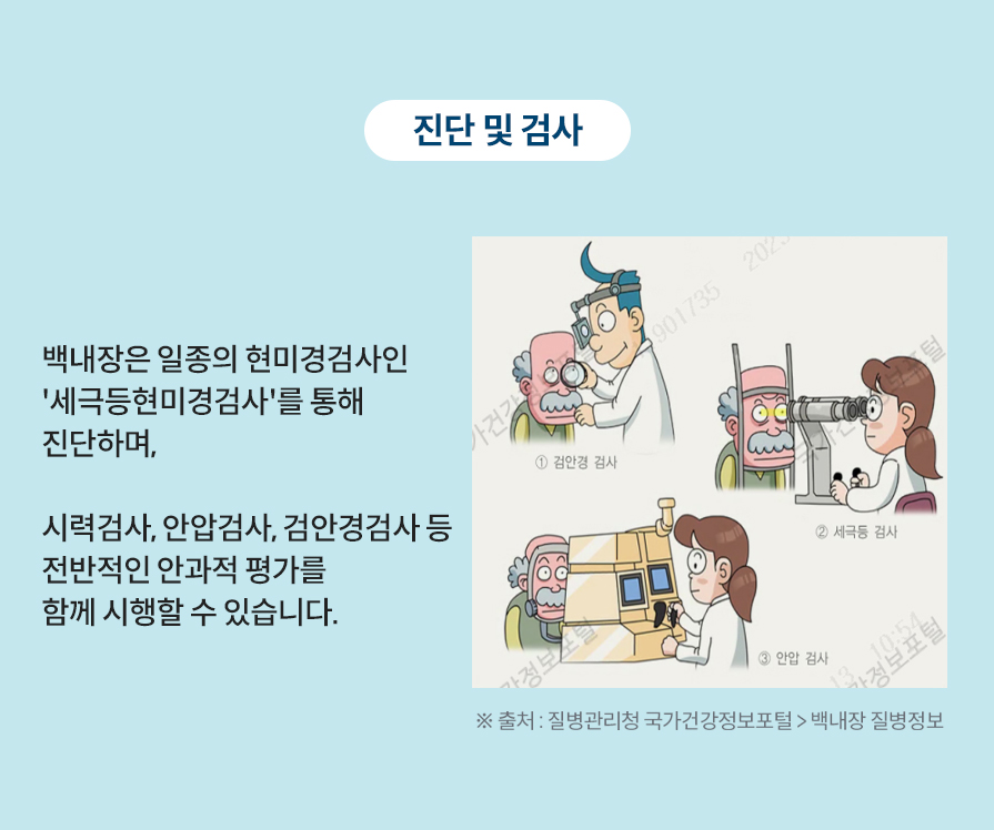 진단 및 검사: 백내장은 일종의 현미경검사인 '세극등현미경검사'를 통해 진단하며, 시력검사, 안압검사, 검안경검사 등 전반적인 안과적 평가를 함께 시행할 수 있습니다.