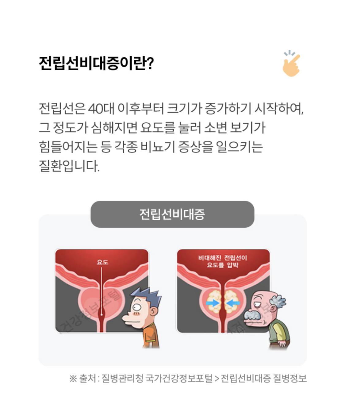 전립선비대증이란?